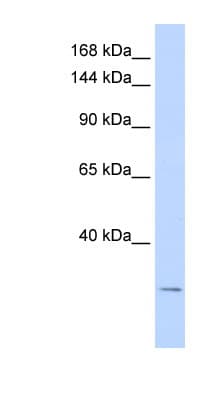 KCNK6 / TWIK-2 Antibody (aa71-120)