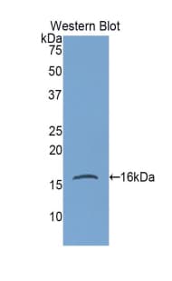 GKN1 / Gastrokine 1 Antibody (aa27-151)
