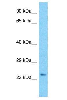 Polyclonal Rabbit anti-Human CDCA3 Antibody (aa151-200, WB)