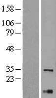 Human XBP1 Protein (Over-Expression Lysate Myc-DDK (Flag))