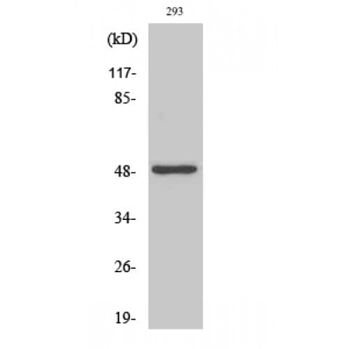 NEUROD2 Antibody (30-110 aa, Internal)