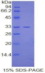 Human MAPK1 / ERK2 Protein (Recombinant His-T7)