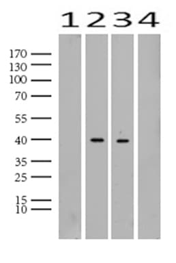 TNNT2 / CTNT Antibody (clone UMAB205, Carrier-free)