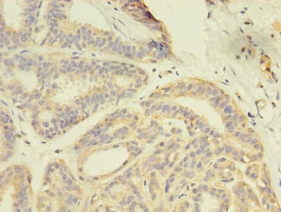 GDI2 Antibody (aa1-445)