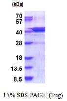 Human HYKK / AGPHD1 Protein (Recombinant His)