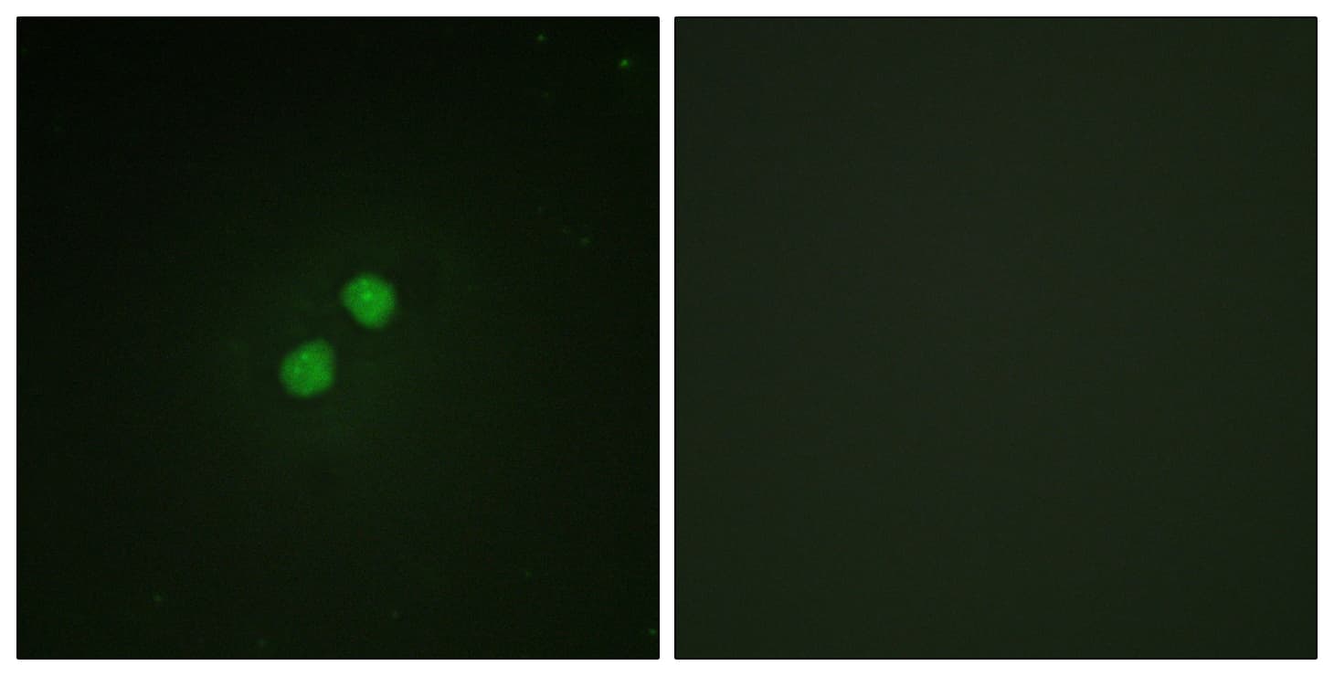 Polyclonal Rabbit anti-Human NBN / Nibrin Antibody (phospho-Ser278, IF, WB)