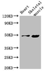 EDNRB / Endothelin B Receptor Antibody