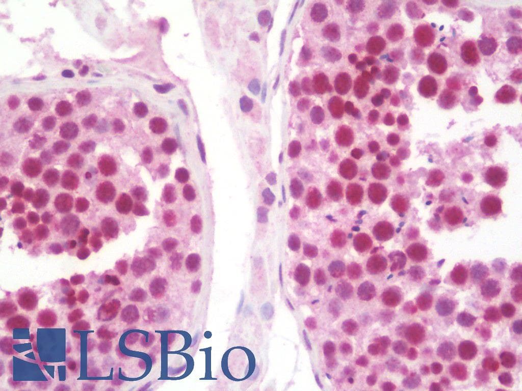 IHC-plus™ CCNT1 / Cyclin T1 Antibody