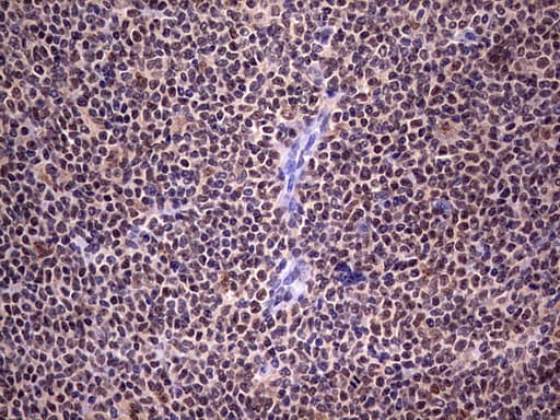 Monoclonal Mouse anti-Human C14orf166 Antibody (clone OTI2C3, IHC, WB)