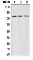 Polyclonal Rabbit anti-Human GRM4 / MGLUR4 Antibody (C-Terminus, IHC, IF, WB)