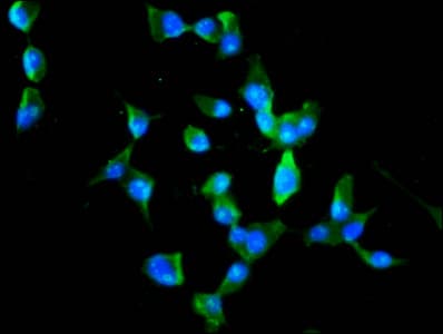 MEX3B / RKHD3 Antibody