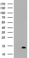 S100B / S100 Beta Antibody (clone OTI6C5)
