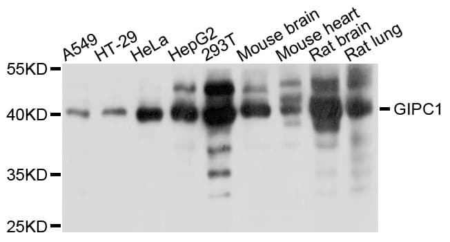 Polyclonal Rabbit anti-Human GIPC1 / GIPC Antibody (WB)