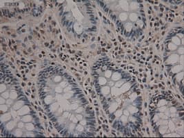 NOTCH1 Antibody (clone OTI3E12)