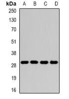 IHC-plus™ GAMT Antibody