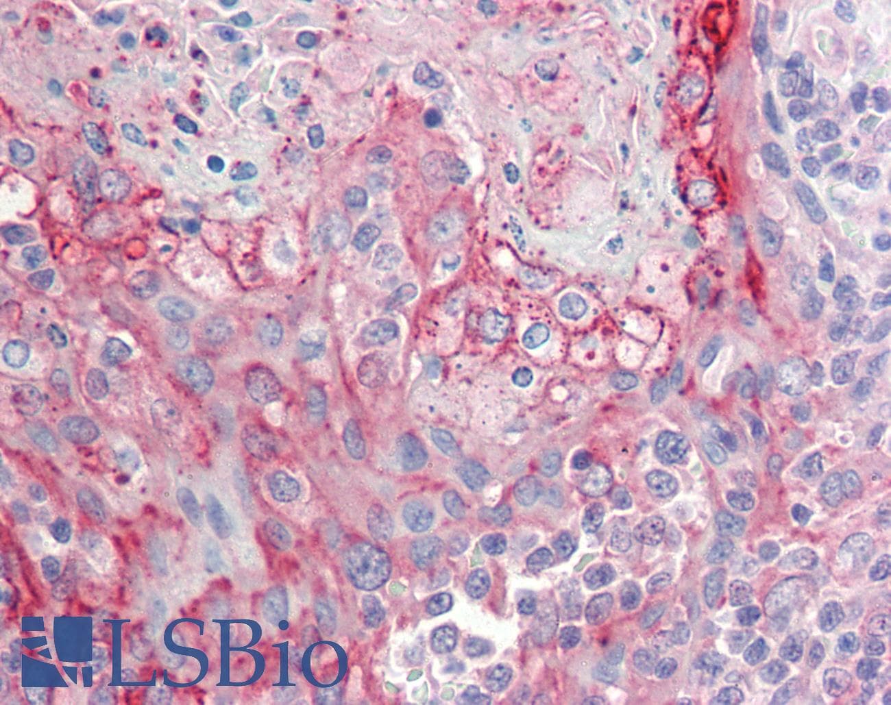 IHC-plus™ RHCG Antibody (aa209-218)