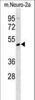 MOK / RAGE Antibody (aa76-104)