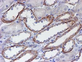 Monoclonal Mouse anti-Human ERBB2 / HER2 Antibody (clone OTI12G4, Carrier-free, aa676-1255, IHC, IF, WB)
