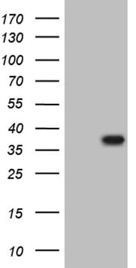THAP5 Antibody (clone OTI2D7)