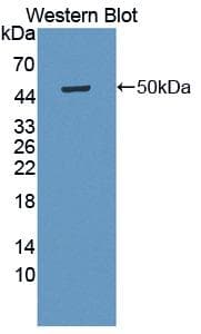Mannose Phosphate Isomerase Antibody (aa2-423, FITC)