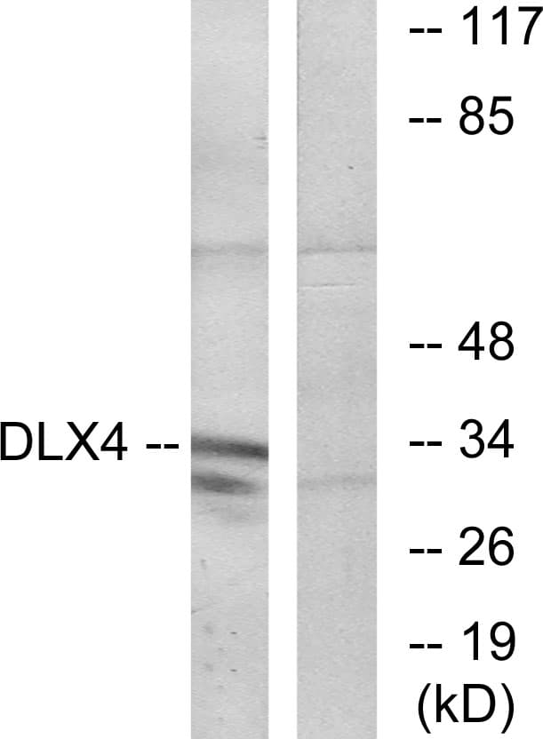 BP1 / DLX4 Antibody (aa61-110)