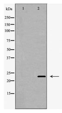 CLDN5 / Claudin 5 Antibody