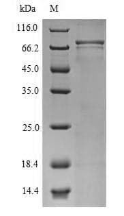 Human CNGA4 Protein (Recombinant 6His-SUMO, N-terminus)