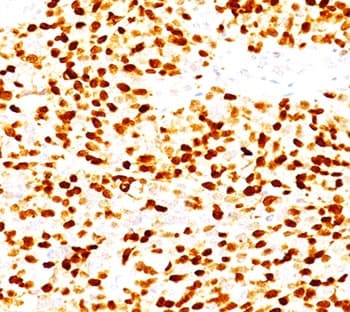 MYOG / Myogenin Antibody (clone MGN185)