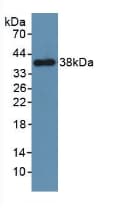 PDGFRB / PDGFR Beta Antibody (aa337-583, Biotin)