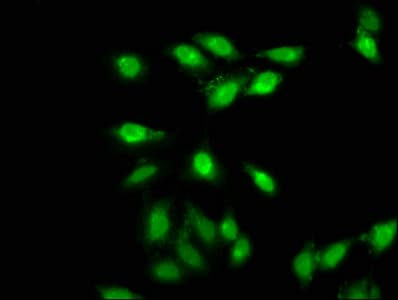 Polyclonal Rabbit anti-Human AMMECR1 Antibody (IHC, IF)