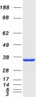 Human PNP / Nucleoside Phosphorylase Protein (Recombinant Myc-DDK (Flag))