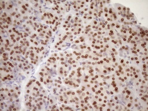 MED15 / ARC105 Antibody (aa393-679, clone OTI1C11)