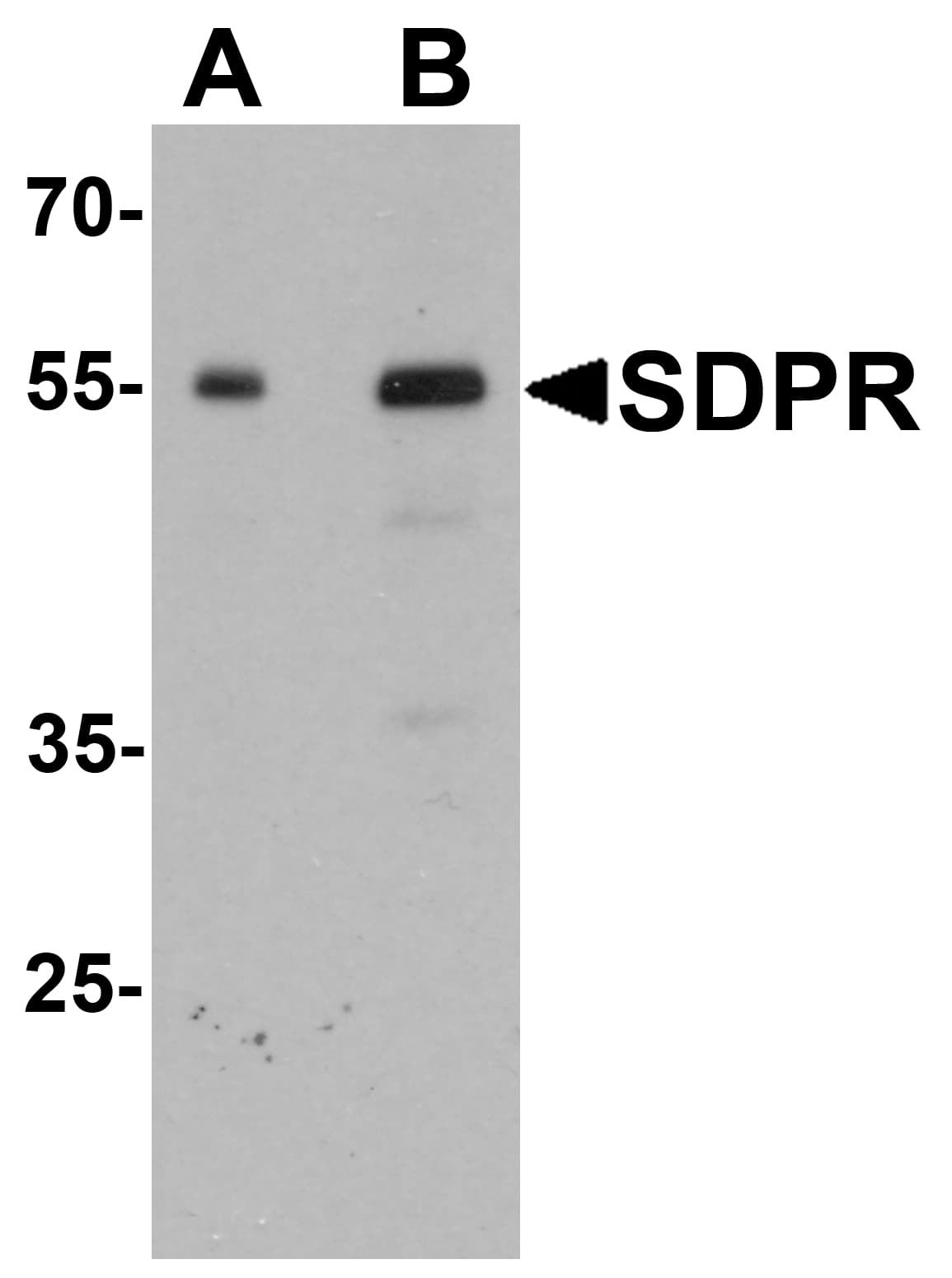 IHC-plus™ Polyclonal Rabbit anti-Human PTRF / CAVIN Antibody (IHC, IF, WB)
