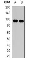 STAT5B Antibody