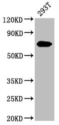 Polyclonal Rabbit anti-Human Alpha-Fetoprotein Antibody (WB)