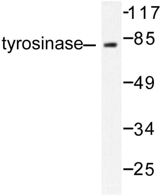 Tyrosinase Antibody (Arg501)