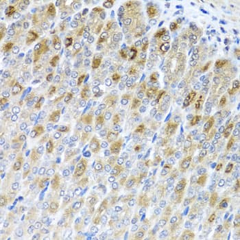 MTX2 Antibody
