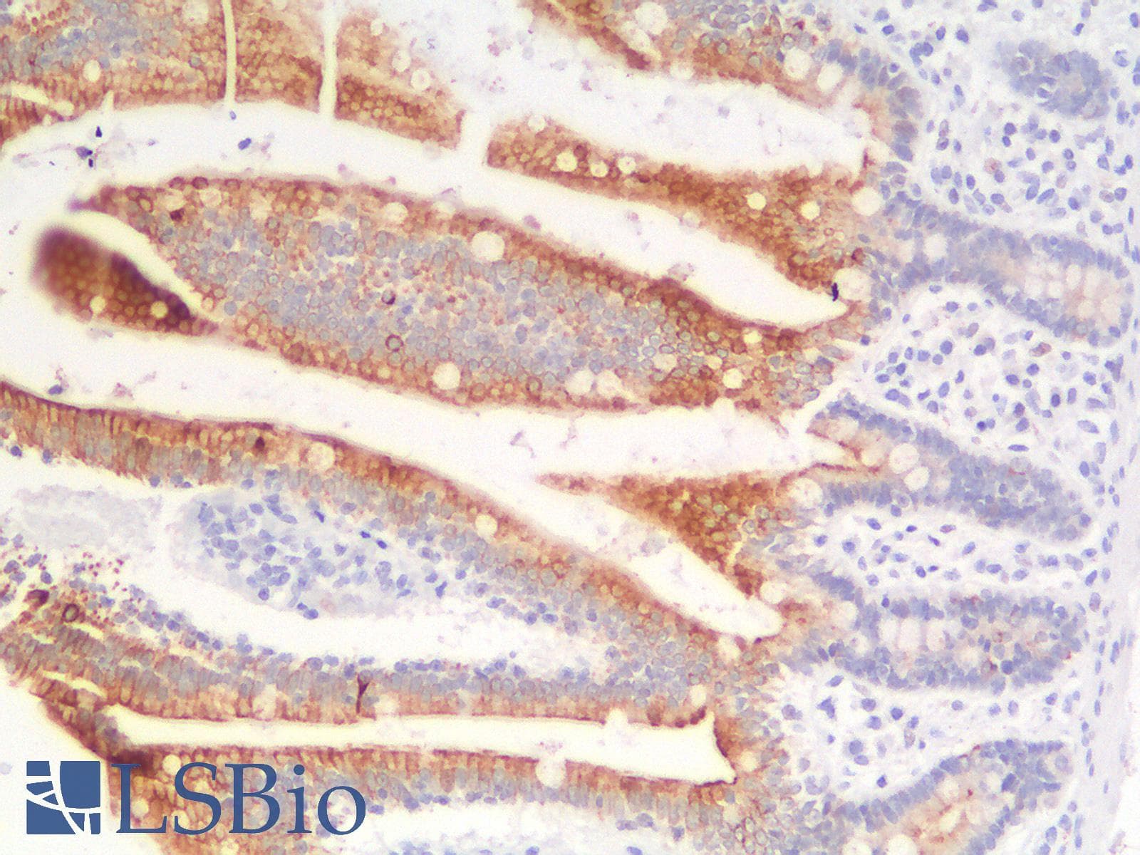 IHC-plus™ KRT8 / CK8 / Cytokeratin 8 Antibody (clone rB22.1)