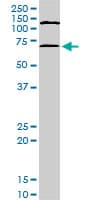 MAPKAPK2 / MAPKAP Kinase 2 Antibody (clone 3B8)