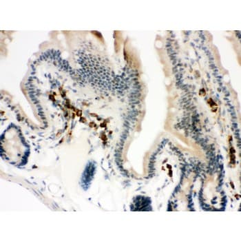 ACTA1 / Skeletal Muscle Actin Antibody (aa359-377)