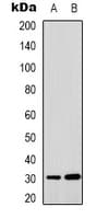 IF3mt / MTIF3 Antibody (Internal)