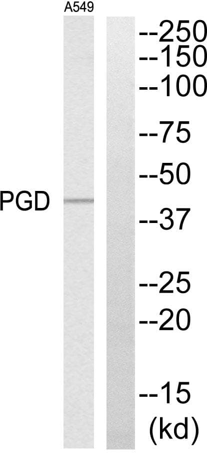 PGD Antibody