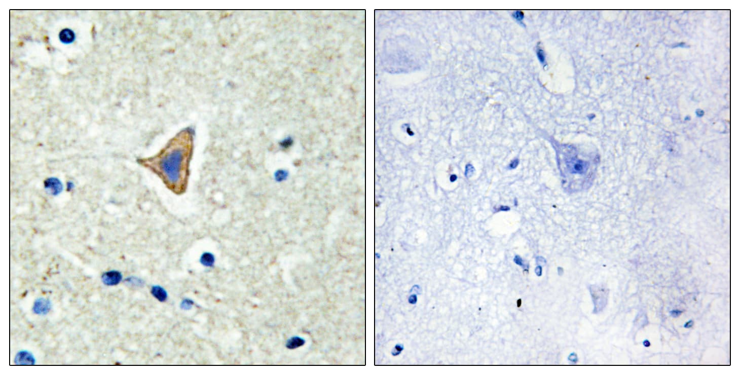 CDH20 / Cadherin 20 Antibody (aa111-160)