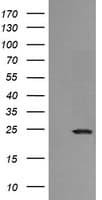 RAB21 Antibody (clone OTI4A6)