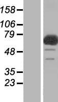 C17orf70 Protein (Over-Expression Lysate Myc-DDK (Flag))