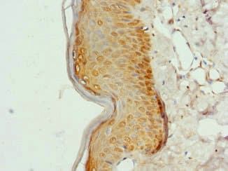 Polyclonal Rabbit anti-Human COL9A3 / Collagen IX Antibody (IHC, WB)