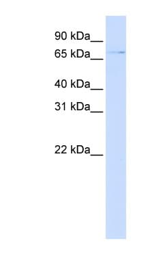 Polyclonal Rabbit anti-Human ZNF324 / ZF5128 Antibody (aa144-193, WB)