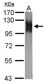 Polyclonal Rabbit anti-Drosophila Atpalpha Antibody (Internal, IHC, WB)