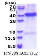 Human EIF3I / EIF3S2 Protein (Recombinant His)