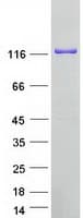 Human RENT1 / UPF1 Protein (Recombinant Myc-DDK (Flag))